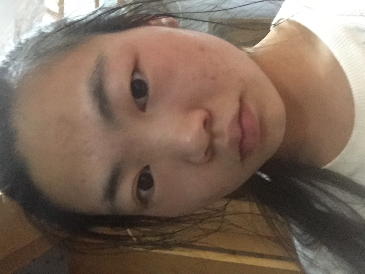脸过敏肿了怎么办